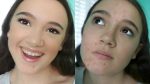 Covering Acne With Drugstore Makeup (Tutorial) FionaFrills