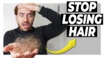 LOSING HAIR? Here's How FIX it PERMANENTLY! Men's Hair Tips