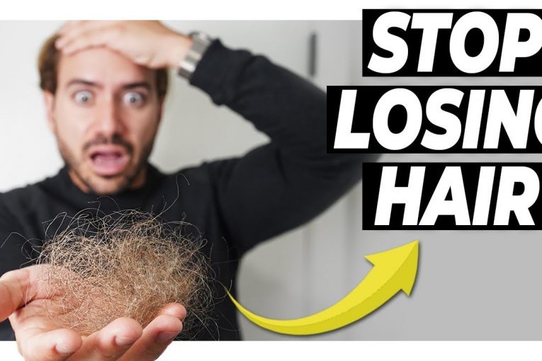 LOSING HAIR? Here's How FIX it PERMANENTLY! Men's Hair Tips